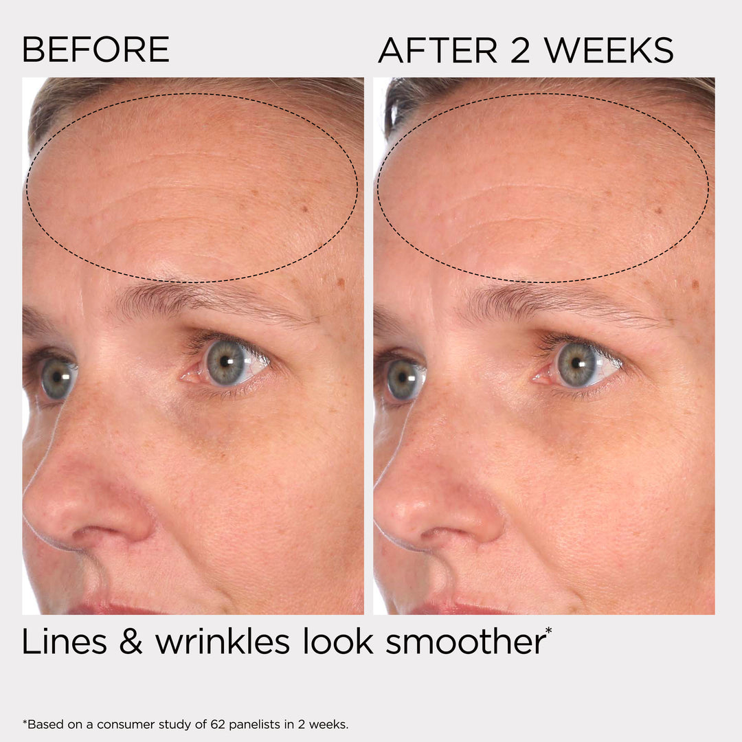 PREVAGE® Multi-Restorative Day Cream With Sunscreens