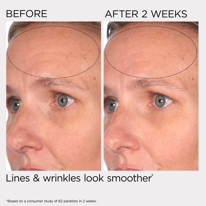 PREVAGE® Multi-Restorative Day Cream With Sunscreens